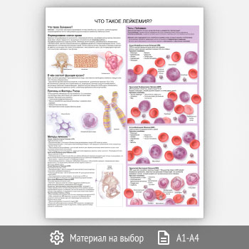 Плакат «Что такое лейкемия?» (ЗОЖ-16, 1 лист)