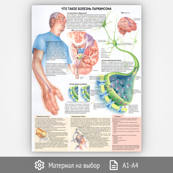 Плакат «Что такое болезнь Паркинсона?» (ЗОЖ-29, 1 лист)